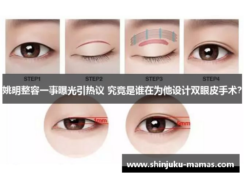 姚明整容一事曝光引热议 究竟是谁在为他设计双眼皮手术？